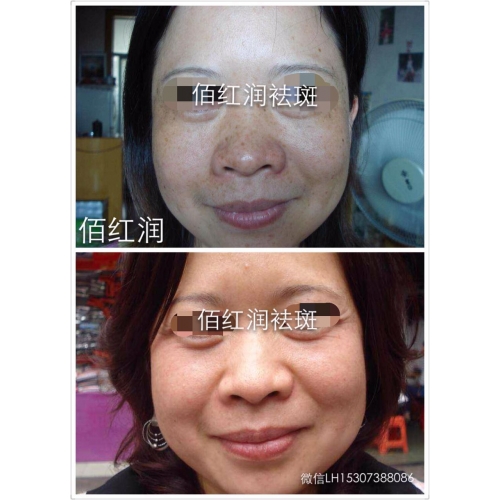 前后对比照