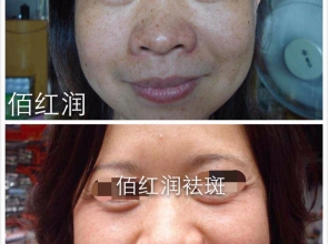 前后对比照