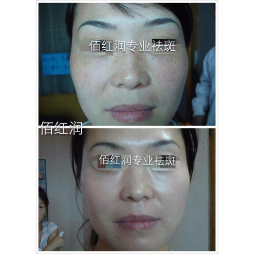 前后对比照
