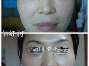 前后对比照