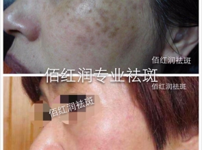 前后对比照