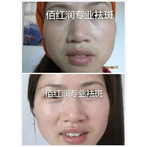 前后对比照