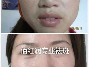 前后对比照