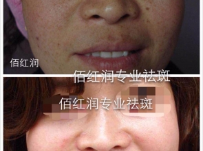 前后对比照